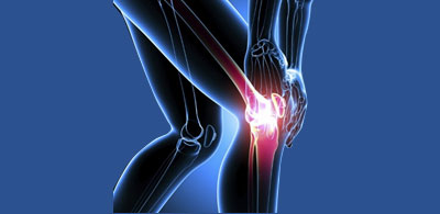 Arthritis Pain Inflammation 1