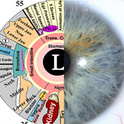 Iridology